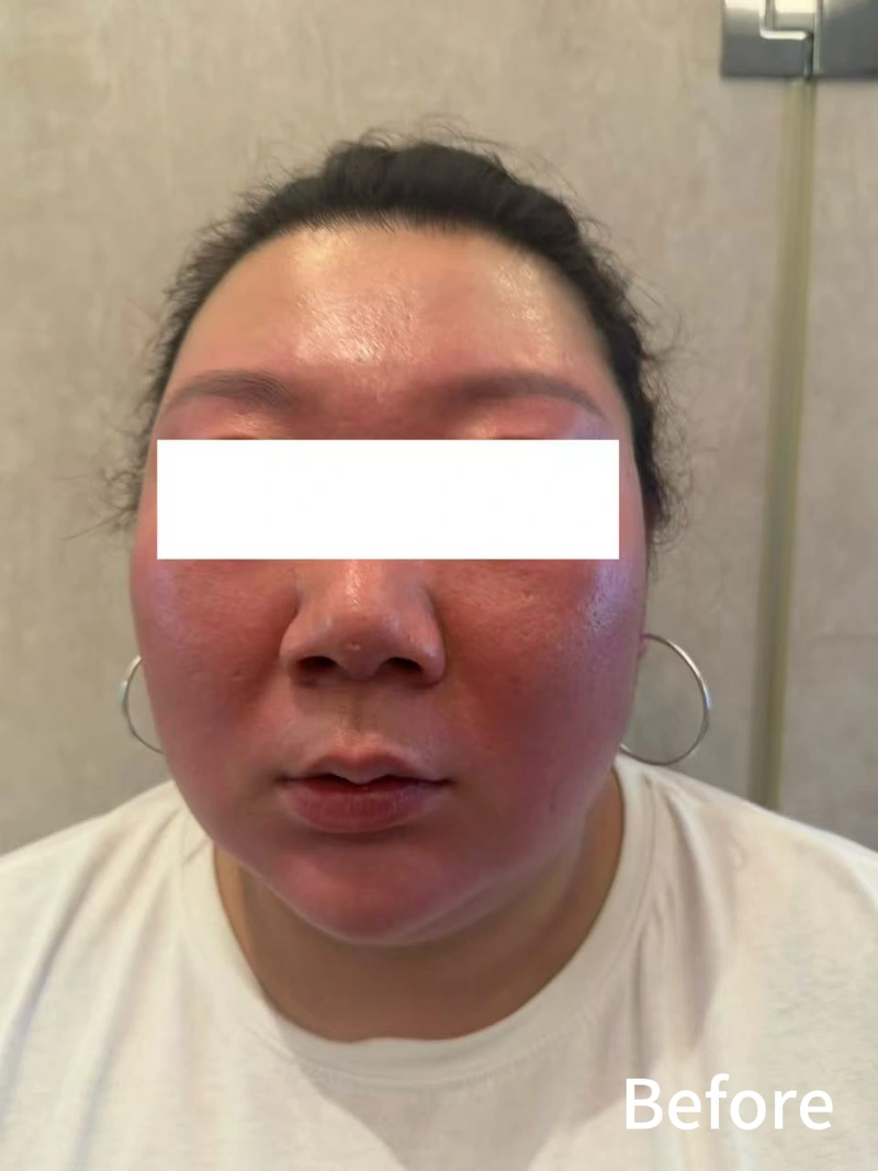 Cream user feedback photograph labelled Before, with the eye area covered